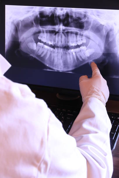 Best Emergency Root Canal Therapy in Natchez, MS