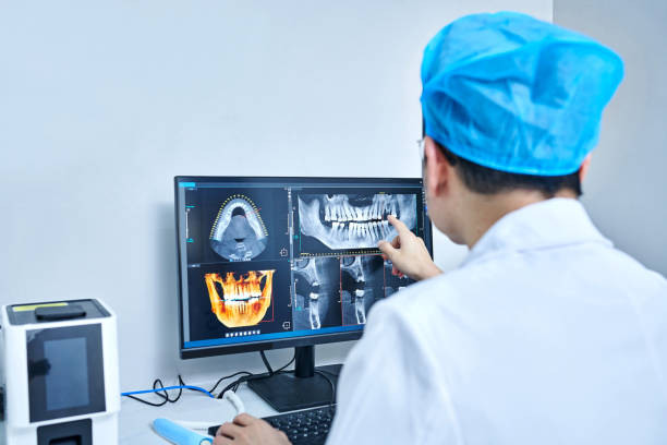 Best Knocked-Out Tooth (Avulsed Tooth) Treatment in Natchez, MS